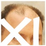 XI. Foto: www.atlasceska.cz XI